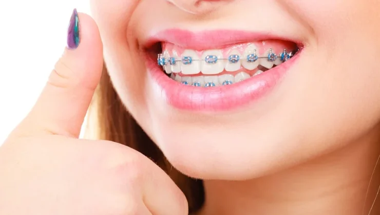Orthodontic Treatment