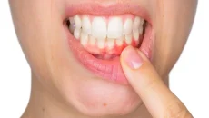 6 At Home Strategies To Complement General Dental Treatments
